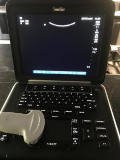 2015 Sonosite Edge Ultraschall Ultrasound C60X HFL50X Sonden